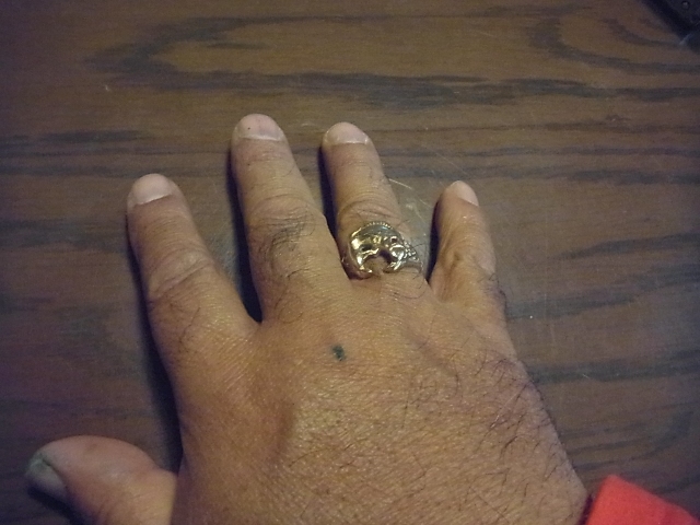 779ring